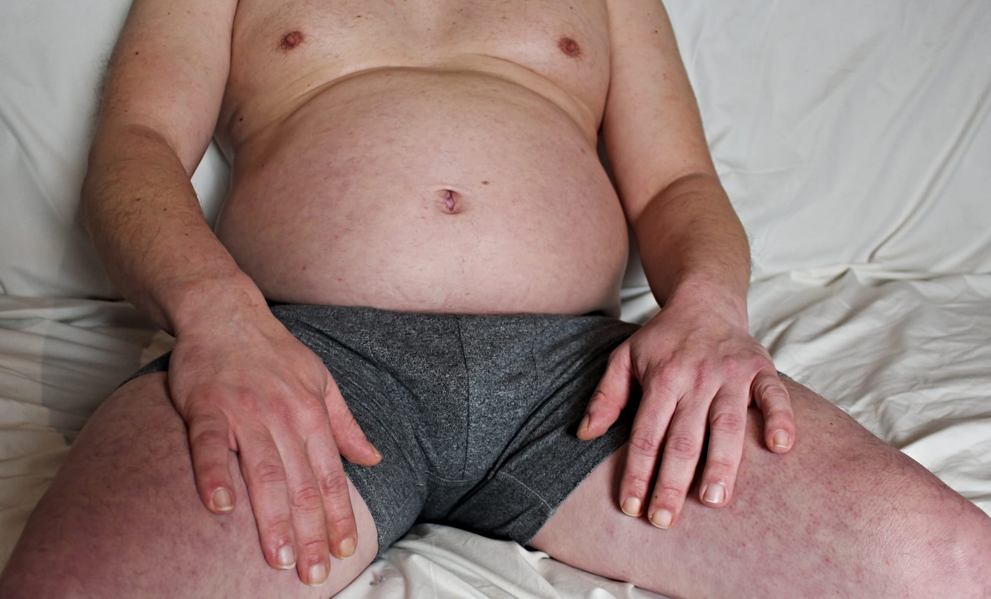 The Dick Diaries: MS